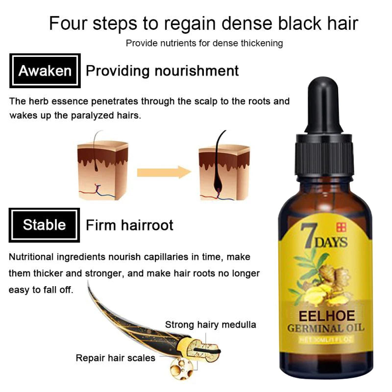 Hair Ginger Essential Germinal Oil Moisturizing & Nourishes Strengthen Hair Roots Scalp Treatment Hair Care